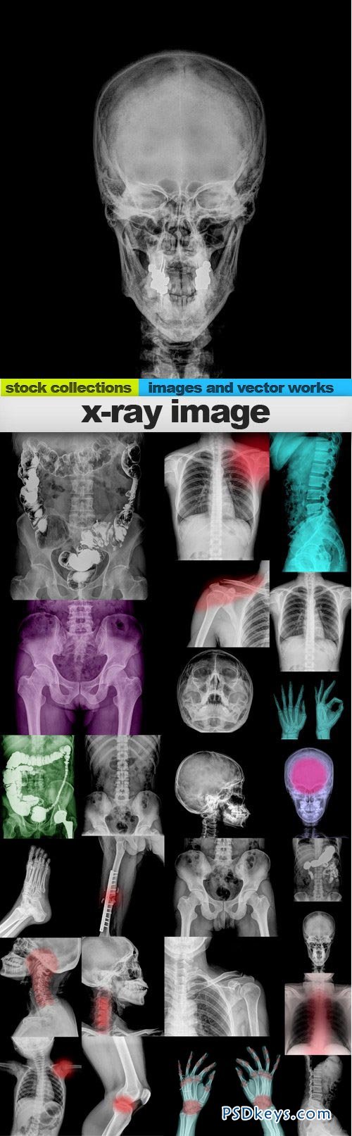 X-ray image 25xUHQ JPEG
