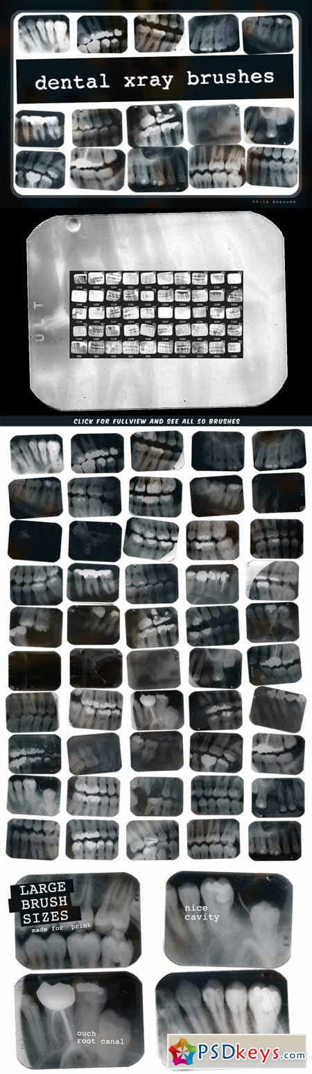 Dental X-ray Brushes 123161