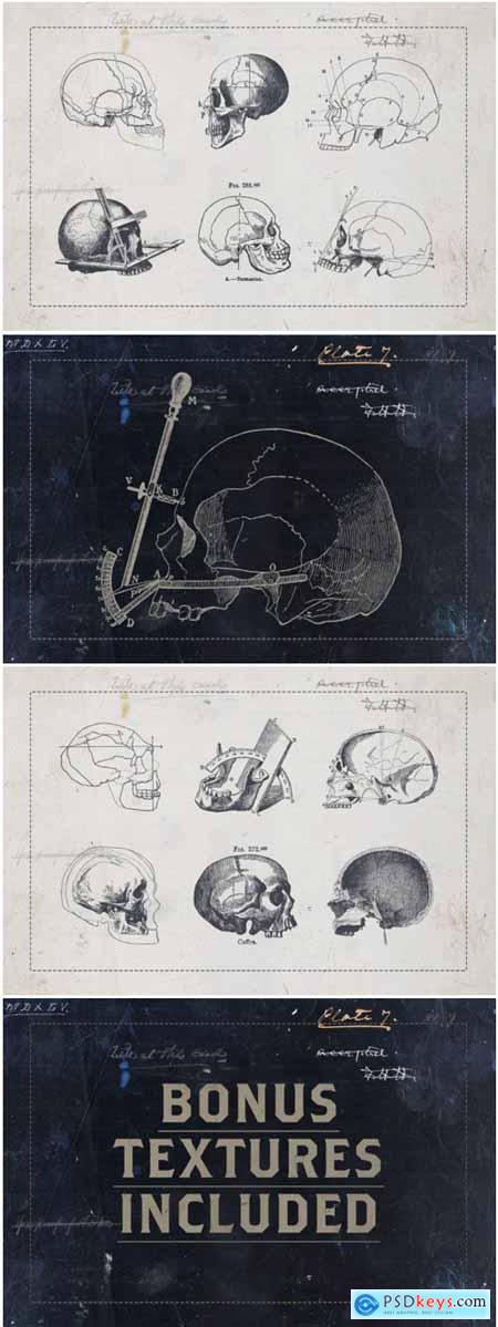 Craniometry