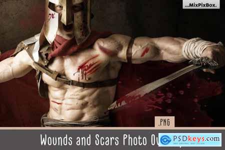 Wounds and Scars Overlays 5326626