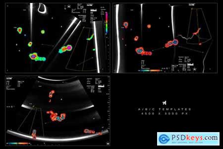 Echo Scan Distortion Effect