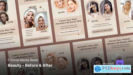 Social Media Reels - Beauty Before and After 45981770