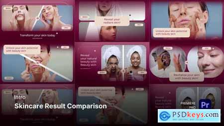 Intro - Skincare Result Comparison Premiere Pro Templates 59410241