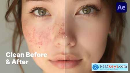 Minimalistic & Clean Before & After Comparison  Premiere Pro Template 60207350